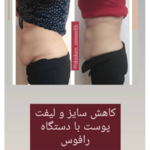 مرکز فشیال سمانه حافظی