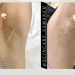 مرکز فشیال سمانه حافظی