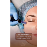 فیشال تخصصی و پاکسازی عمقی پوست نفیس