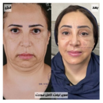 دکتر یوسف شفائی