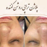 سالن زیبایی لیلا حاتمی