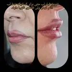 کلینیک زیبایی ویتالیتا