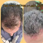 کلینیک زیبایی ویتالیتا