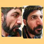 کلینیک زیبایی ویتالیتا