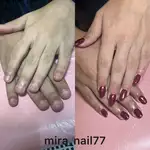 کاشت ناخن میرا