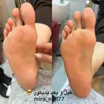 کاشت ناخن میرا