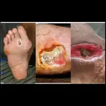 سهیلا اسماعیلی درمانگر زخم