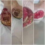 درمانگر زخم دانیال مدبری
