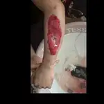 درمانگر زخم و استوما علیرضا علیپور 