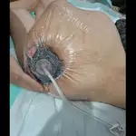 درمانگر زخم و استوما علیرضا علیپور 