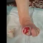 درمانگر زخم و استوما علیرضا علیپور 