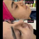 فشیال تخصصی و جوانسازی پوست سمیرا شیدایی