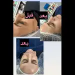 فشیال تخصصی و جوانسازی پوست سمیرا شیدایی