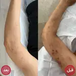  مرکز تخصصی مرکز فیشیال  شیدی اسکین 