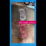 آیدا علیزاده درمانگر زخم
