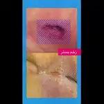آیدا علیزاده درمانگر زخم