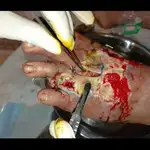 کارشناس تخصصی زخم و استومی حامد رمضانی
