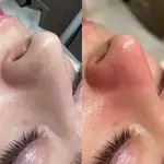 فشیال تخصصی و مراقبت پوست رضوان فرخ