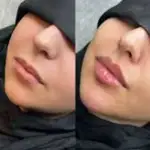 بهترین کلینیک زیبایی و پوست و مو  بلوط