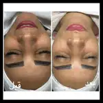 مرکز تخصصی فیشال وآبرسانی پوست نرگس