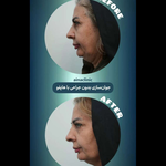 کلینیک درمانی زیبایی آینا