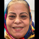 دندانساز و پروتز متحرک مدرن اشرفی