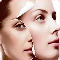 related-image