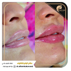 کلینیک زیبایی دکتر الهام کاکاوند