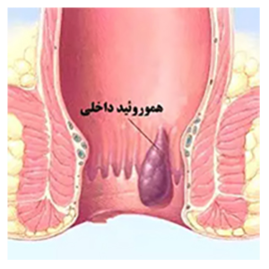 متخصص جراحی عمومی لاپاراسکوپی دکتر حسین تارور...